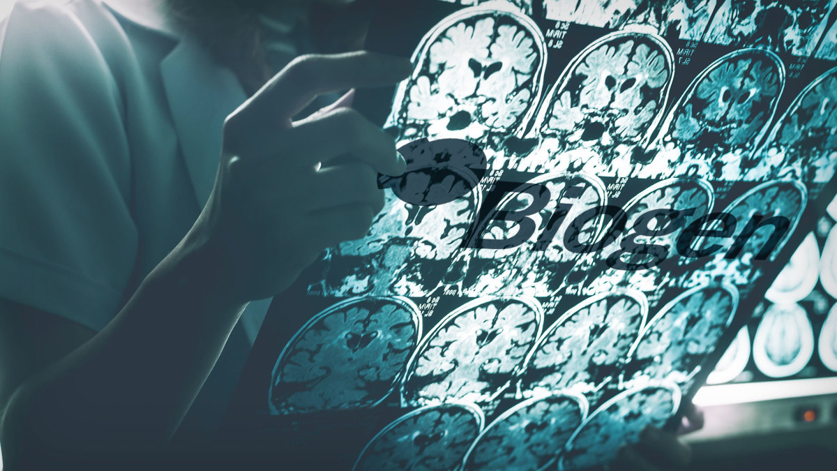 Should Biogen Investors Be Worried About Its Alzheimer's Drug? - TheStreet